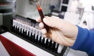 a person in the medical field holding a vile with blood in it