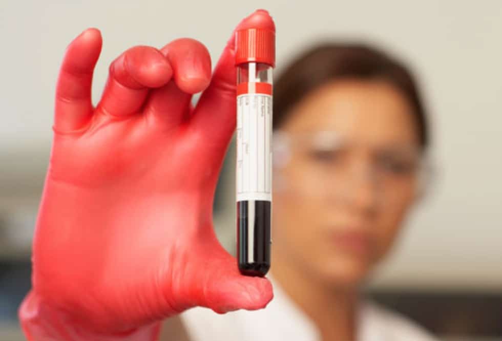 Insights from Anti-Aging Blood Tests