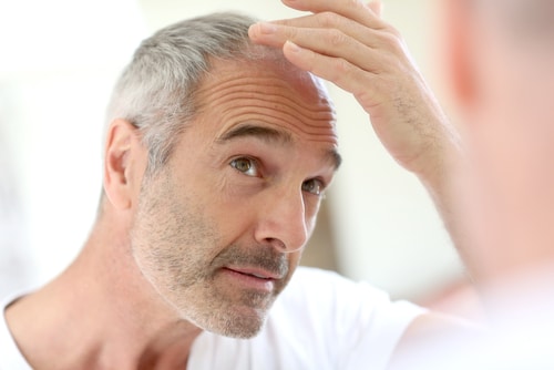 What Blood Tests are Done for Hair Loss? 