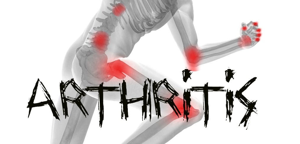 Stop Living in Pain: Diagnose and Treat Arthritis