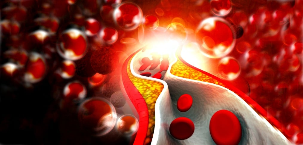 Lipid Profile Panel