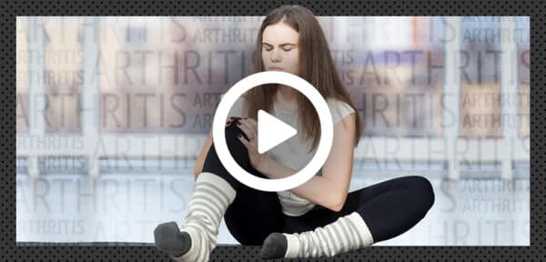 Arthritis Video Quiz