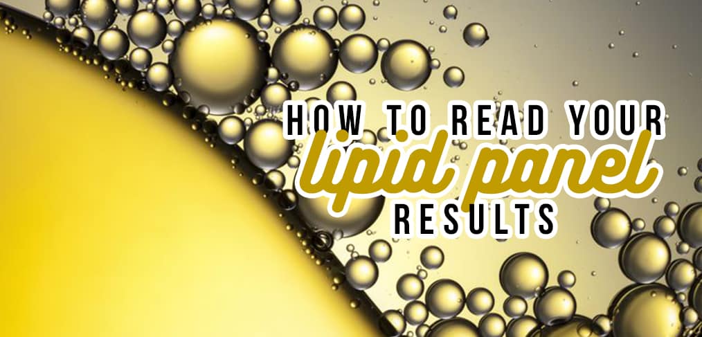 How To Read Your Lipid Panel Results