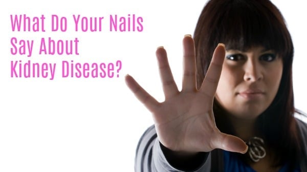 What Do Your Nails Say About Kidney Disease?