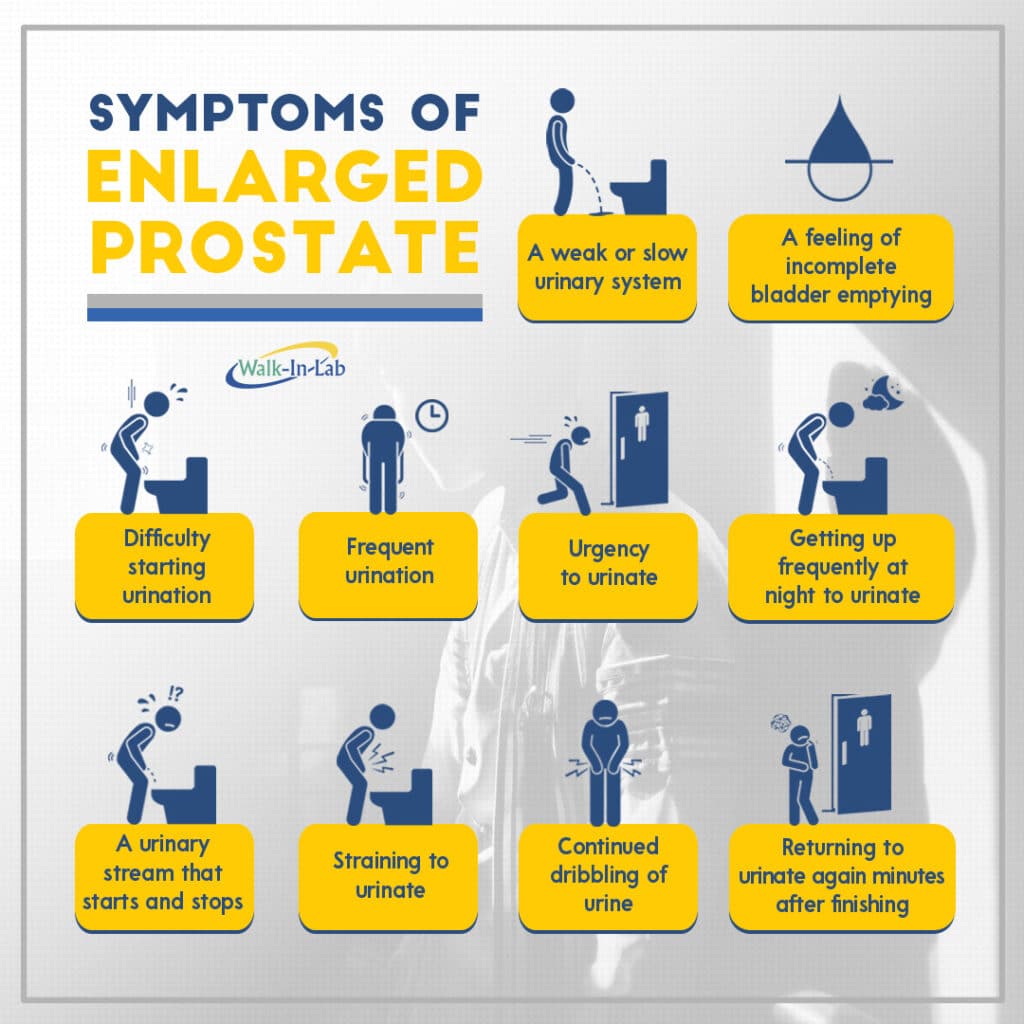 Prostate Problems?  These Are The Main Symptoms