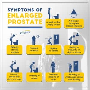 Symptoms of enlarged prostate infographic