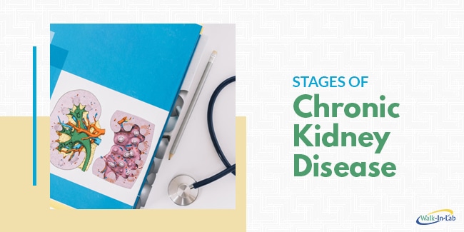 Stages of Chronic Kidney Disease