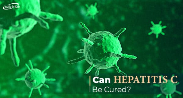 Can Hepatitis C be cured?