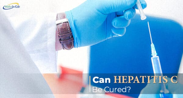 Can Hepatitis C be cured?