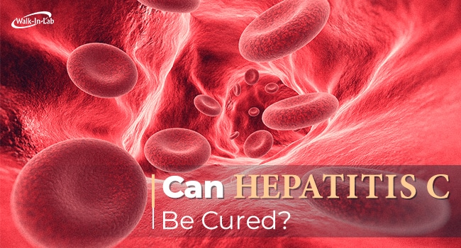 Can Hepatitis C Be Cured?