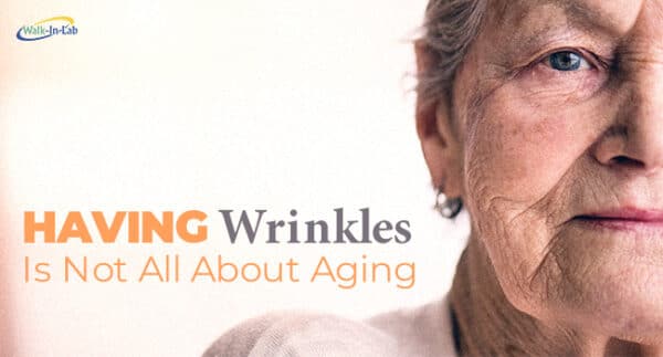 Having wrinkles is not all about aging