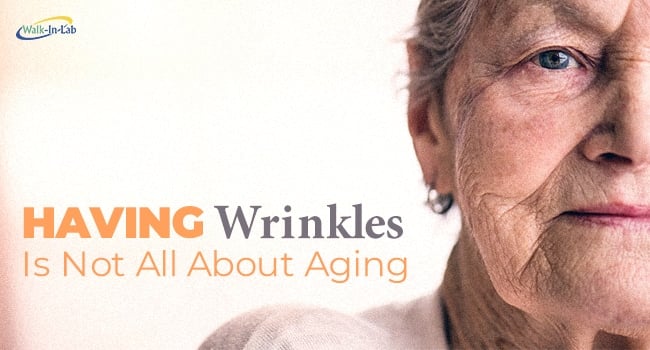 Having Wrinkles Is Not All About Aging