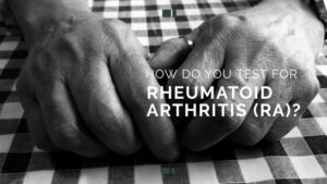 How Do You Test for Rheumatoid Arthritis (RA)?