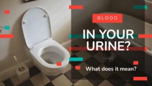 Additionally, your doctor could ask for a blood test, MRI, or any other tests that serve him or her to confirm a diagnosis. The treatment for hematuria depends on the diagnosis. For example, if you have a UTI, your doctor may resort to a urine culture to identify the germs that are causing the infection and prescribe the most accurate antibiotics for you. Urinary tract cancers are usually treated with chemotherapy, radiation therapy, and/or surgery to extract the affected organ partially or completely. For example, the surgeon may remove the bladder and conduct a urinary diversion to reroute the urine out of your body through an opening in the abdomen and into a collecting bag. Or they may create a new bladder out of loops of the intestine. This new bladder can be directly connected to the urethra or it may need to be manually emptied with a catheter. Sometimes, the cause of hematuria can't be identified, and therefore, there's no applicable treatment. Many times, the blood in the urine disappears on its own. But if there's blood in your urine, don't dismiss it, even if it’s a small amount and/or you only see it once. Pay a visit to your healthcare professional and get yourself examined as soon as possible