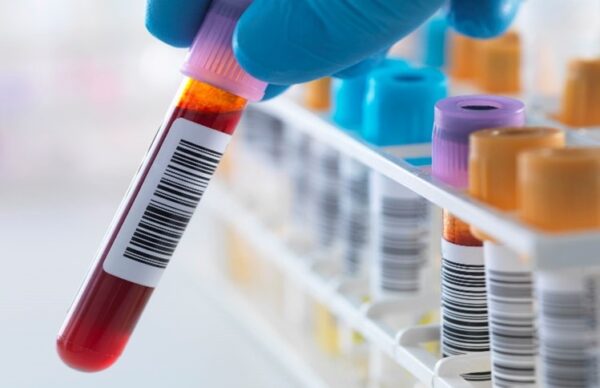 hand holding a vial of blood next to an organizer with vials of blood for testing