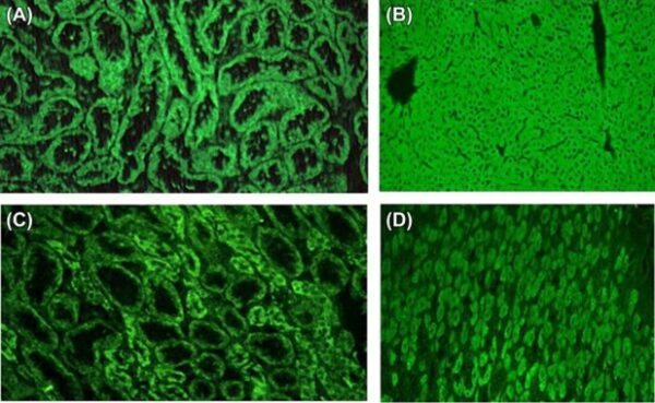 Liver Kidney Microsomal