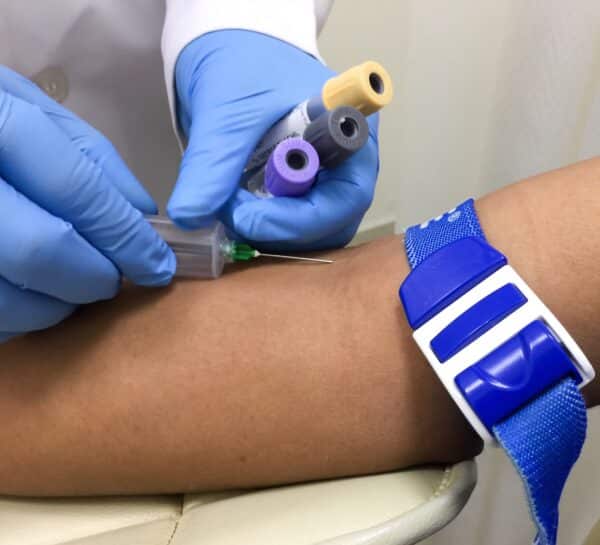 Getting blood drawn for a blood test