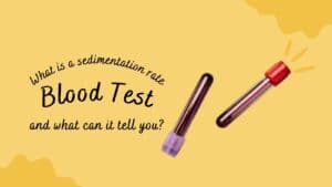 What is a sedimentation rate blood test and what can it tell you?