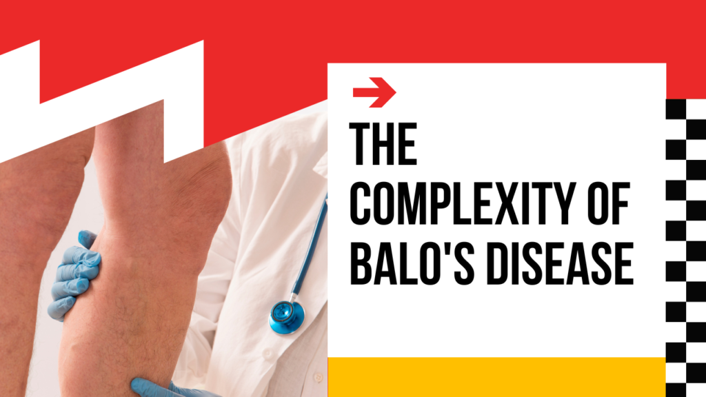 The Complexity of Balo’s Disease