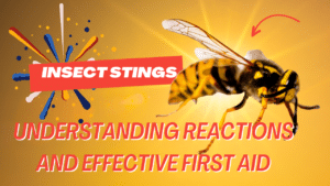 Insect stings: understanding reactions and effective first aid