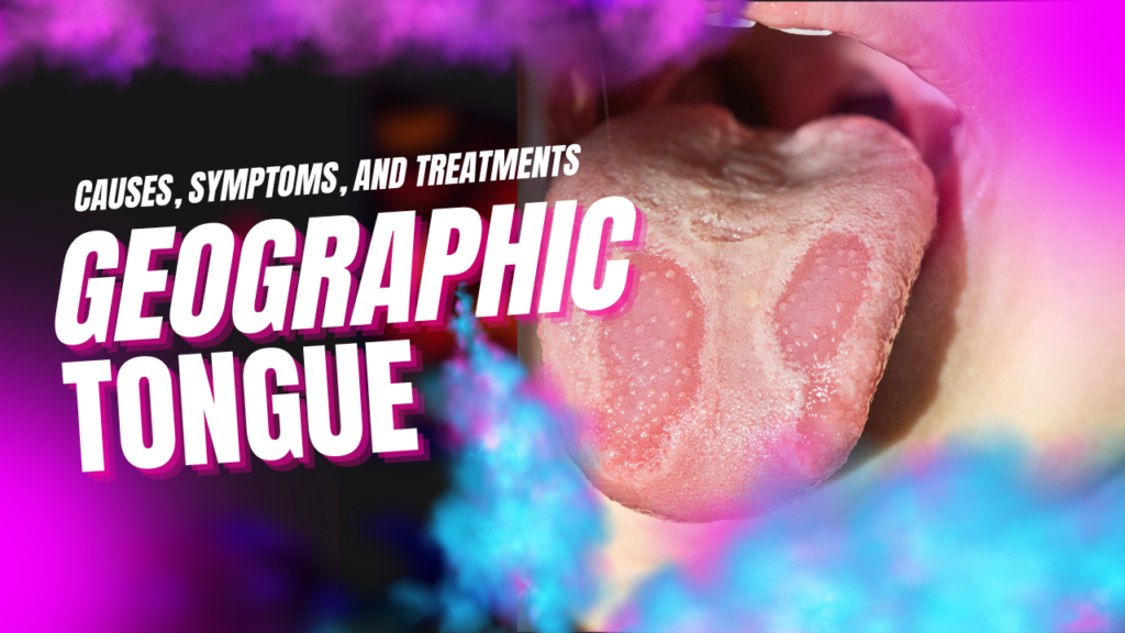 Geographic tongue: causes, symptoms, and treatments