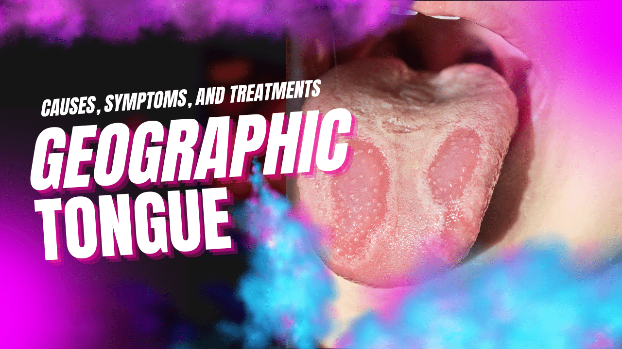 Understanding Geographic Tongue Causes Symptoms And Treatments