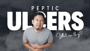Peptic ulcers, what are they?