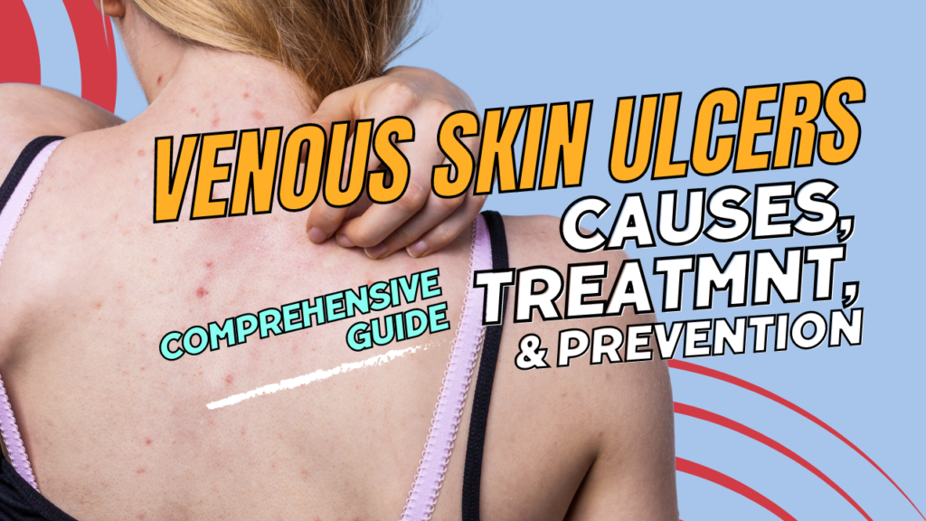 Venous Skin Ulcers: Comprehensive Guide to Causes, Treatments, and Prevention