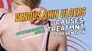Venous skin ulcers: comprehensive guide of causes, treatment, & prevention