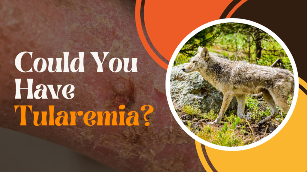 Could You Have Tularemia?