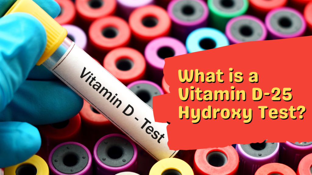 What is a Vitamin D-25 Hydroxy Test?