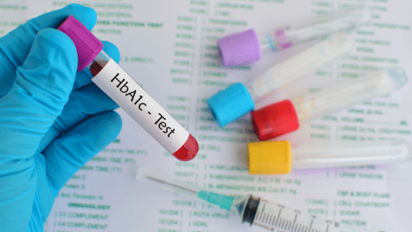The Significance of Hemoglobin A1c Testing in Managing Diabetes and Diet