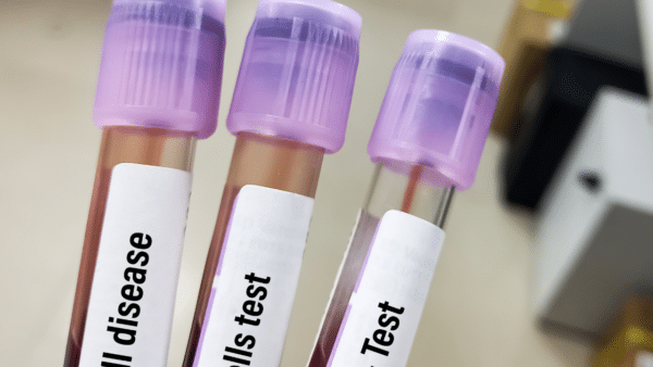 Can a blood test tell you what you should be eating?