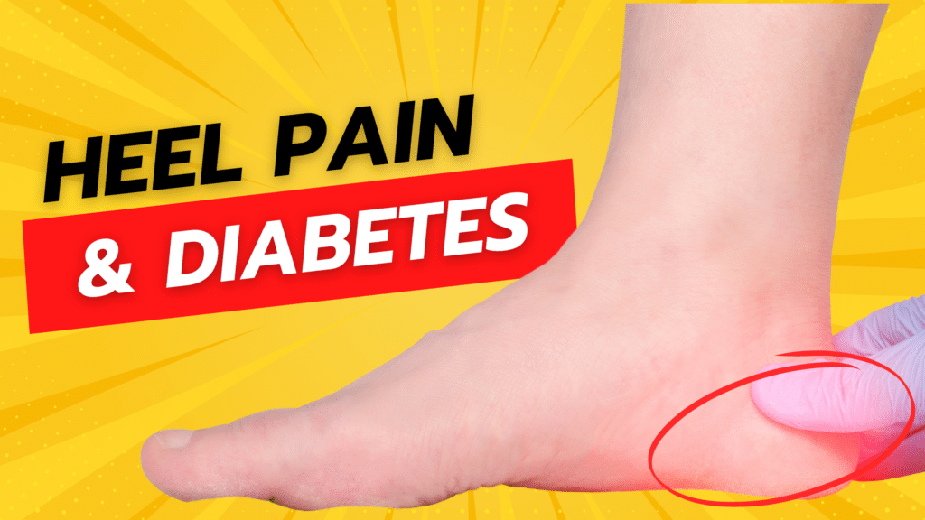 Heel Pain and Diabetes