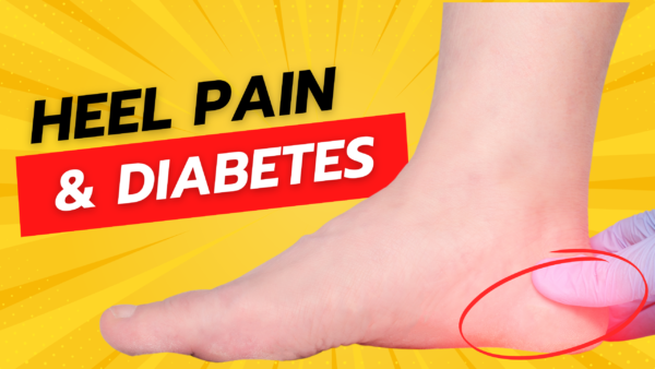 Heel Pain & Diabetes