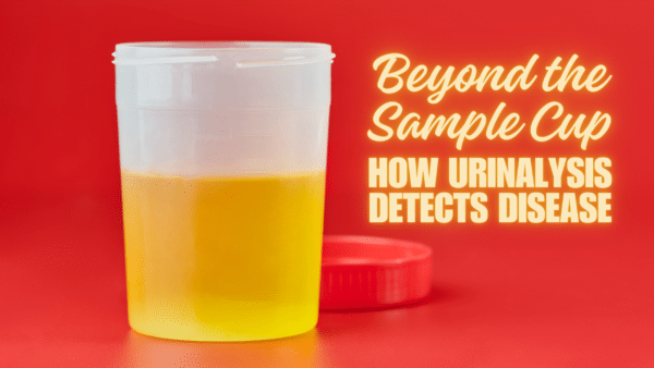 Beyond the sample cup: how urinalysis detects disease