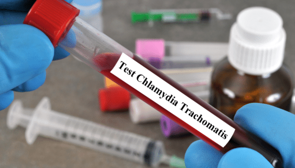 Chlamydia Blood Test