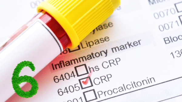 hs-CRP (High Sensitivity C-Reactive Protein)