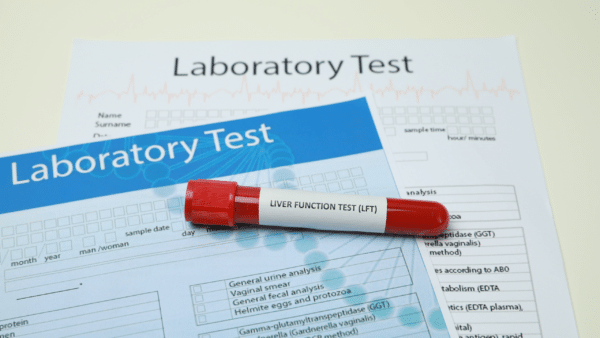 liver blood tests