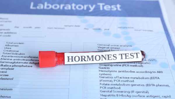 What are male hormone tests