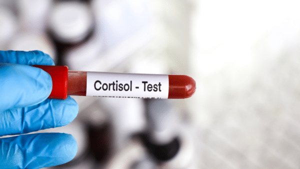 preparing for the cortisol tests