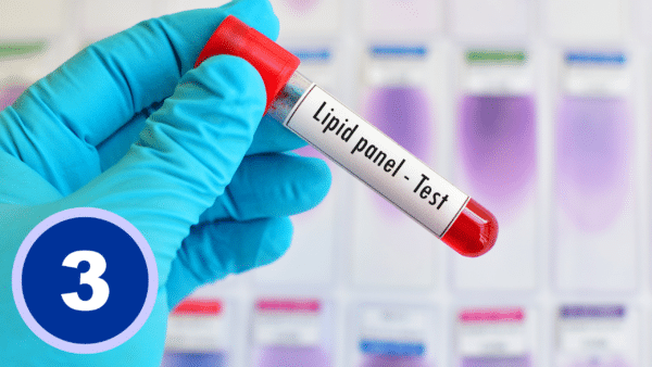 Lipid Panel (Cholesterol and Triglycerides)