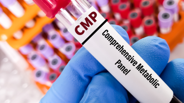 What is the CMP-14 with eGFR?